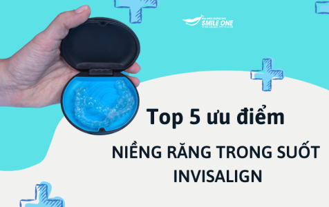 Top 5 ưu điểm của niềng răng trong suốt Invisalign 